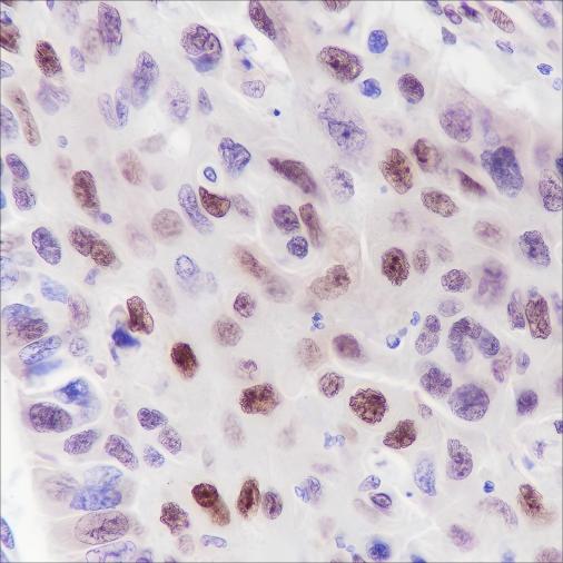 Recombinant Cyclin D3 Monoclonal Antibody - small - 4