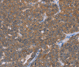FABP6 Polyclonal Antibody - 2