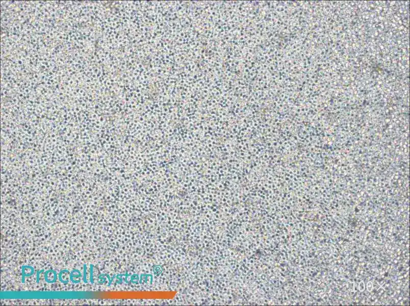 NOMO-1 Cell Complete Medium - 1