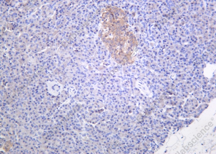 Recombinant Musashi-1 Monoclonal Antibody - 1