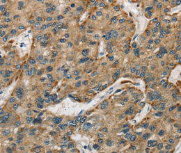 Cathepsin E Polyclonal Antibody - 3