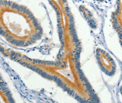 KLC1 Polyclonal Antibody - 2