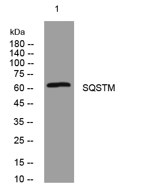 Recombinant SQSTM1/p62 Monoclonal Antibody - 2