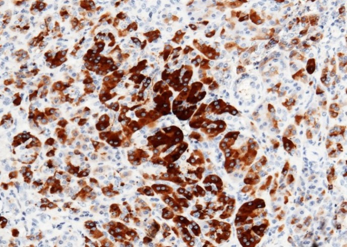 Recombinant REG3A Monoclonal Antibody - small - 2