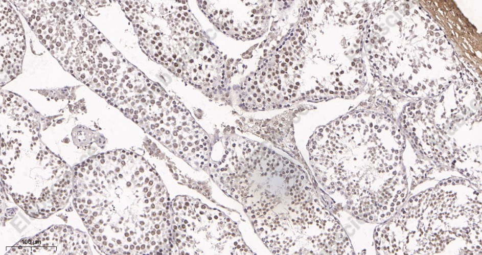 Recombinant METTL3 Monoclonal Antibody - 2