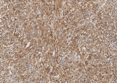 Recombinant Bcl-2 Monoclonal Antibody - small - 3