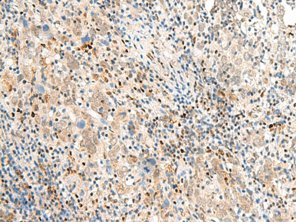 POM121 Polyclonal Antibody - small - 2