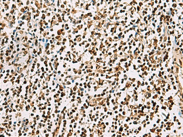 Immunohistochemistry of paraffin-embedded Human tonsil tissue  using FOXI1 Polyclonal Antibody at dilution of 1:55(?200)