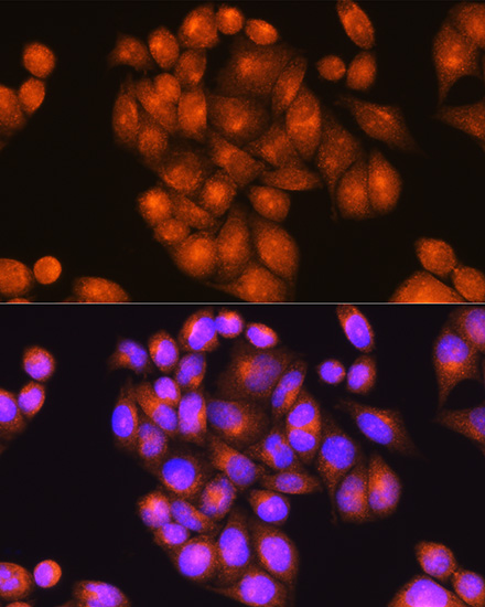 Immunofluorescence analysis of HeLa cells using PSEN2 Polyclonal Antibody at dilution of 1:100 (40x lens). Blue: DAPI for nuclear staining.