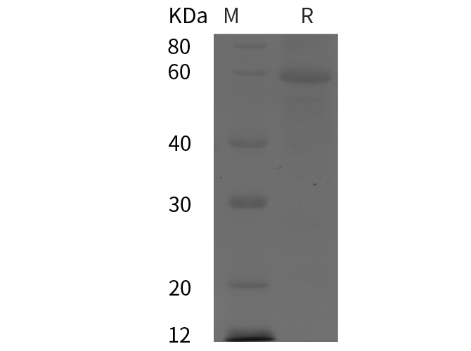 Recombinant Human CXCL10 Protein(His Tag)-产品推荐-1