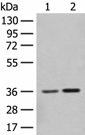 Western blot analysis of Mouse brain tissue and Rat brain tissue lysates  using SLC25A27 Polyclonal Antibody at dilution of 1:350