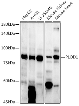 Western blot analysis of extracts of various cell lines using PLOD1 Polyclonal Antibody at 1:1000 dilution.