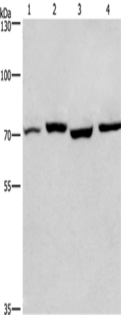 Western Blot analysis of Human fetal liver and Mouse stomach tissue, hela and hepG2 cell using ARNTL Polyclonal Antibody at dilution of 1:450