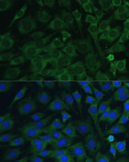 Immunofluorescence analysis of C6 cells using Oncostatin M Polyclonal Antibody at dilution of 1:100. Blue: DAPI for nuclear staining.