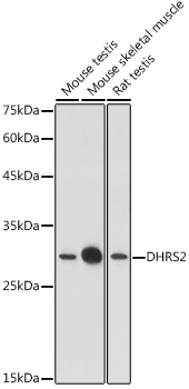 Western blot analysis of extracts of various cell lines using DHRS2 Polyclonal Antibody at 1:1000 dilution.