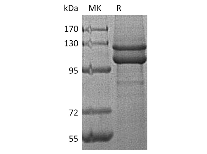 Recombinant Human E-Cadherin/CDH1 Protein (His Tag)
