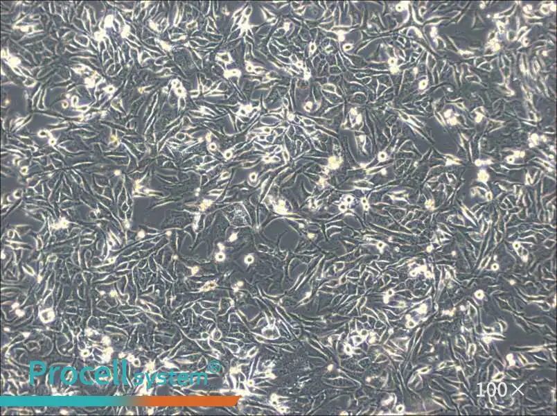 NCI-H596 Cell Complete Medium - 1