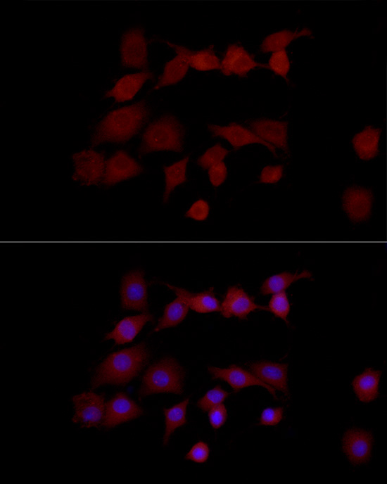 Immunofluorescence analysis of PC-12 cells using NGLY1 Polyclonal Antibody at dilution of 1:50 (40x lens). Blue: DAPI for nuclear staining.