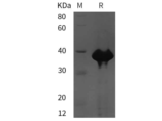 Recombinant Rat IL-10 Protein(Trx Tag)-产品推荐-1