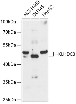 Western blot analysis of extracts of various cell lines using KLHDC3 Polyclonal Antibody at 1:3000 dilution.