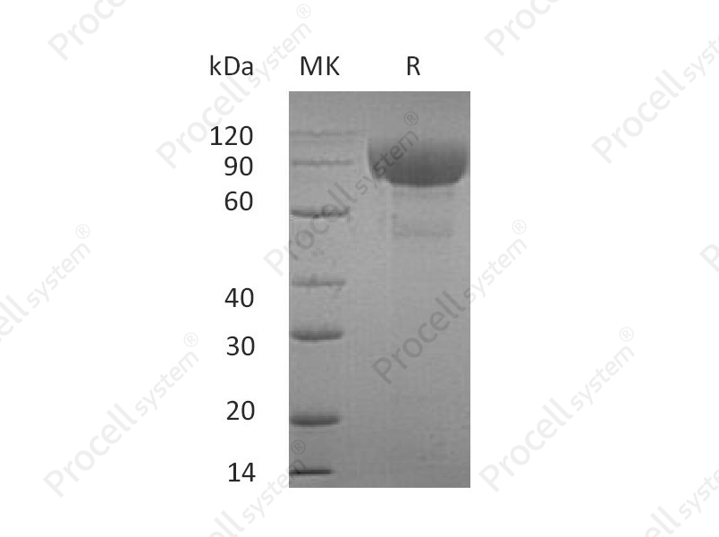 IL-1RL2 (C-Fc), Human, Recombinant