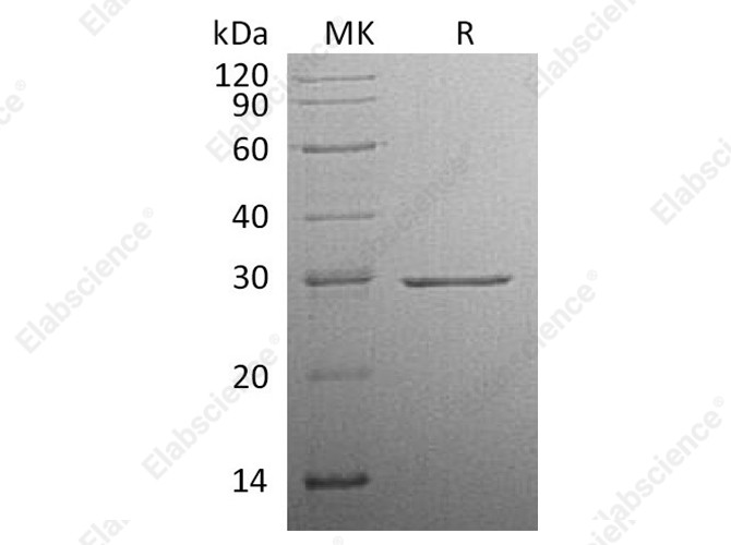 Recombinant Human Factor D Protein (His Tag) - 1