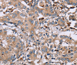 MAGEA3 Polyclonal Antibody - 3