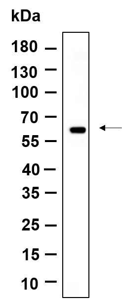 Recombinant Cytokeratin 10 Monoclonal Antibody-searchlist-1
