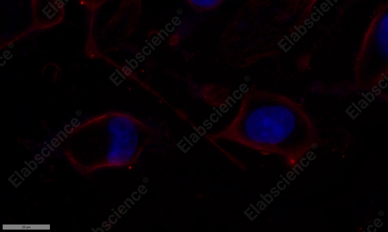 Recombinant PI3-Kinase p85 α Monoclonal Antibody - 7