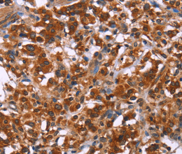 ING2 Polyclonal Antibody - 2