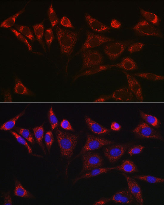 Immunofluorescence analysis of NIH/3T3 cells using KITLG Polyclonal Antibody at dilution of 1:25 (40x lens). Blue: DAPI for nuclear staining.