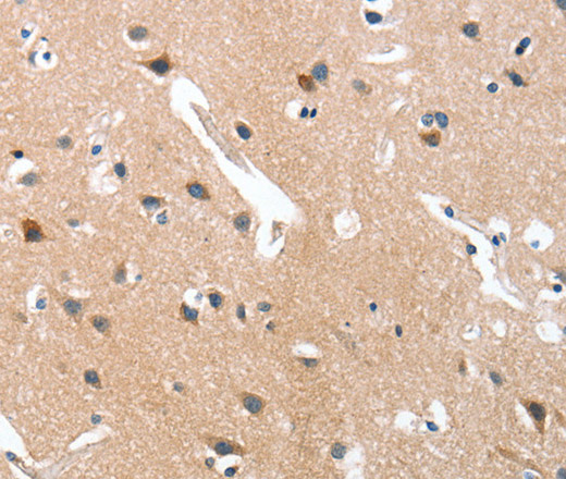 Immunohistochemistry of paraffin-embedded Human brain  tissue using GRB7 Polyclonal Antibody at dilution 1:40