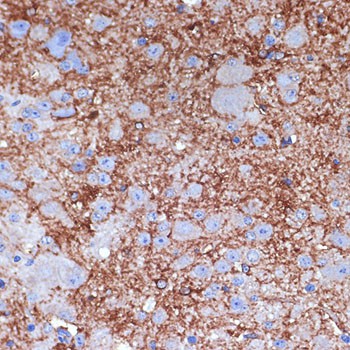 NPY Polyclonal Antibody - small - 2