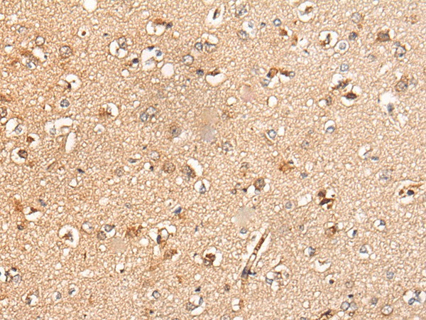 Immunohistochemistry of paraffin-embedded Human brain tissue  using KLHL36 Polyclonal Antibody at dilution of 1:55(?200)