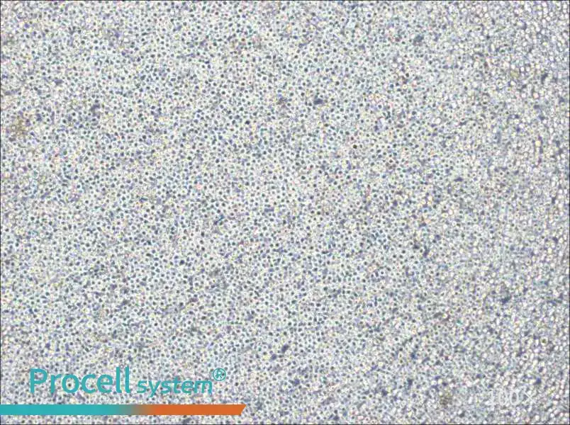 NOMO-1 Cell Complete MediumNOMO-1 Cell Complete Medium - 3