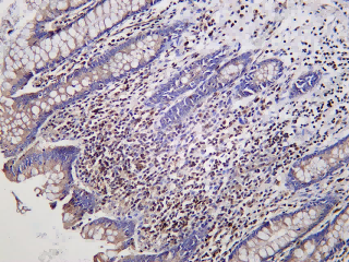 Recombinant FLI1 Monoclonal Antibody - 1