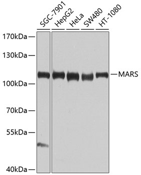 Western blot analysis of extracts of various cell lines using MARS Polyclonal Antibody at 1:1000 dilution.