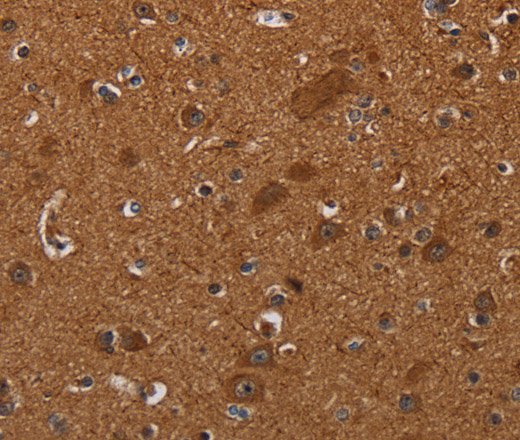 Immunohistochemistry of paraffin-embedded Human brain tissue using CYBB Polyclonal Antibody at dilution 1:40