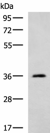 Western blot analysis of Human cerebella tissue lysate  using ATP1B2 Polyclonal Antibody at dilution of 1:650