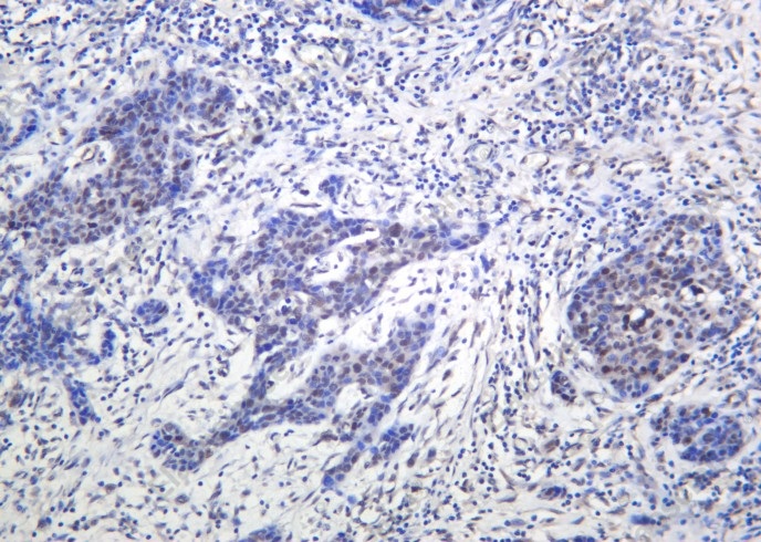 Recombinant Phospho-ATM (Ser1981) Monoclonal Antibody - 2