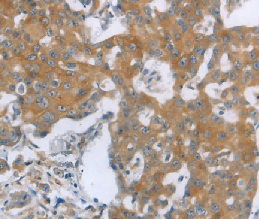TNK2 Polyclonal Antibody - 2