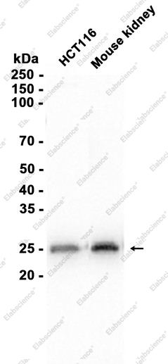 Recombinant MUC1 Monoclonal Antibody - 2