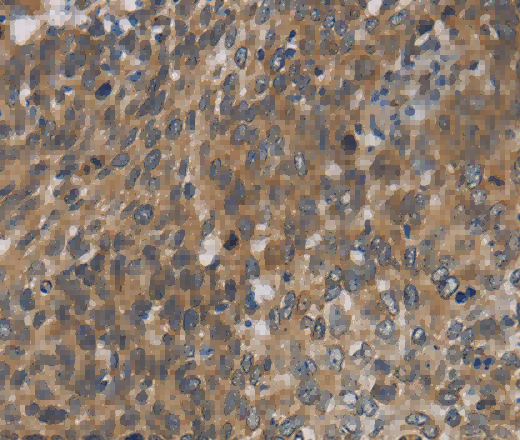 Cytochrome b5 Polyclonal Antibody - 3