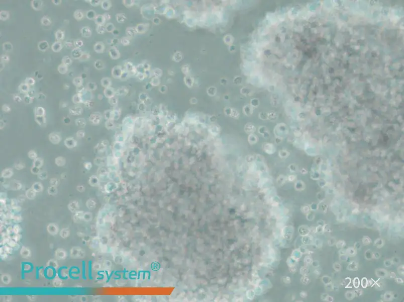 SU-DHL-10 Cell Complete Medium - 4