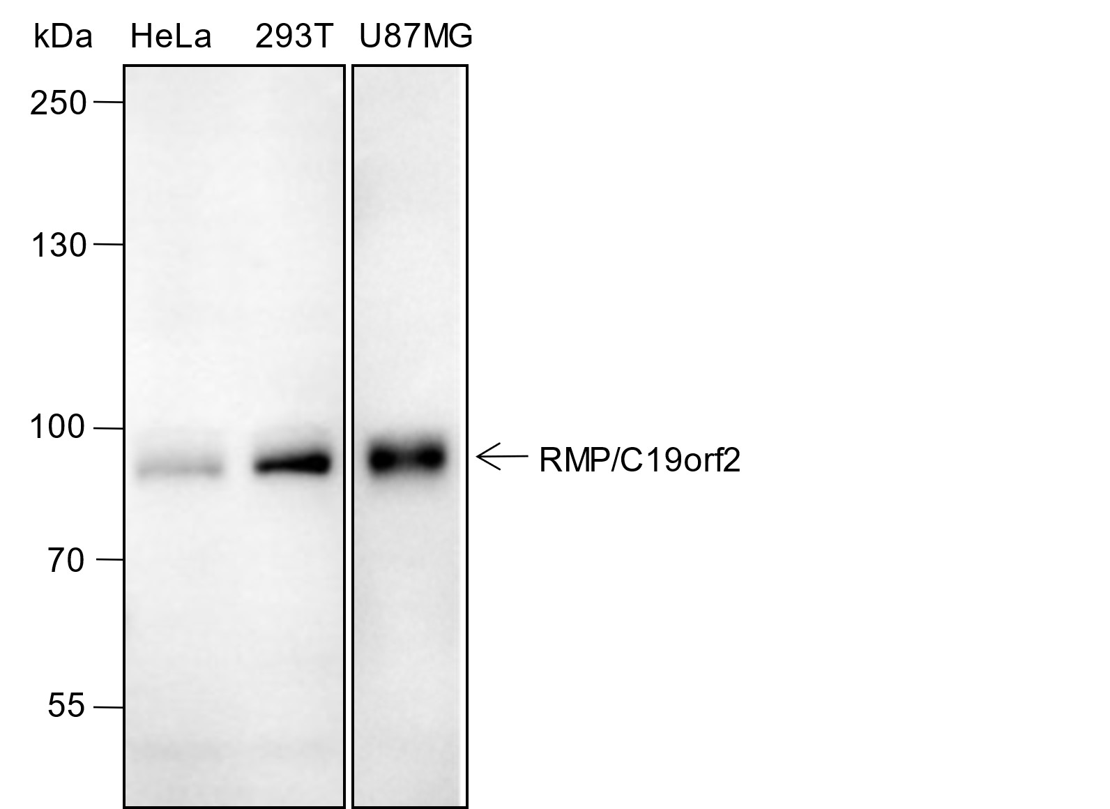 Recombinant RMP/C19orf2 Monoclonal Antibody-searchlist-1
