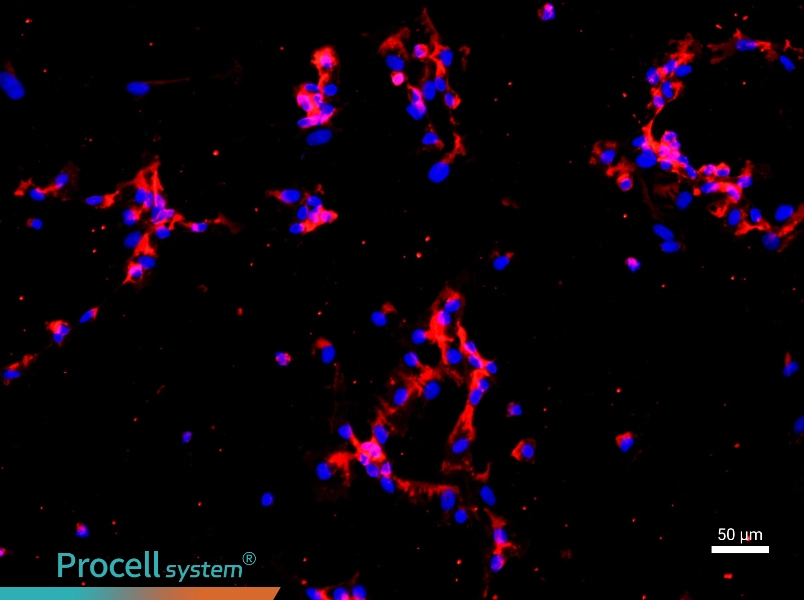 Human Pulmonary Microvascular Endothelial Cell Complete Medium - 1
