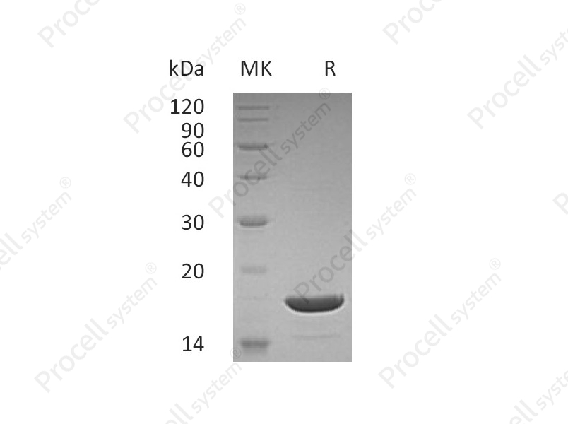 CD253/TNFSF10/TRAIL, Human, Recombinant