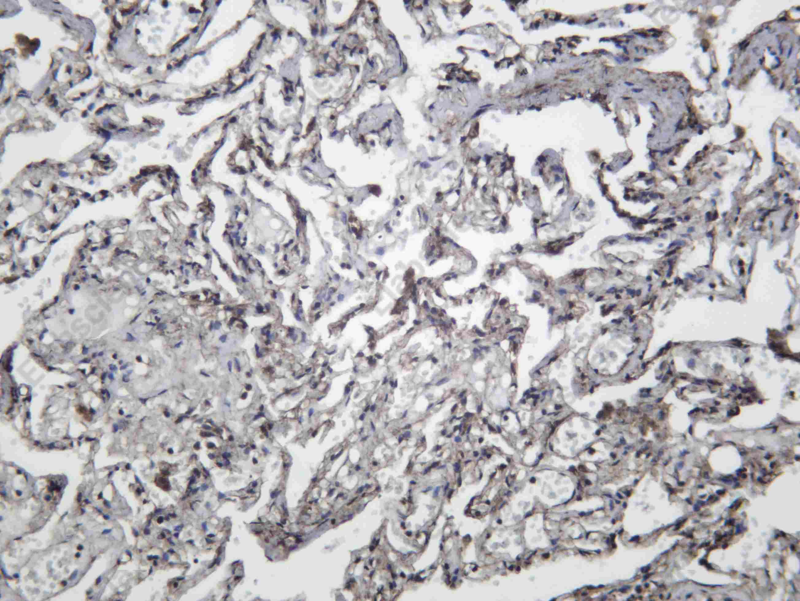 Recombinant VPRBP Monoclonal Antibody - 2