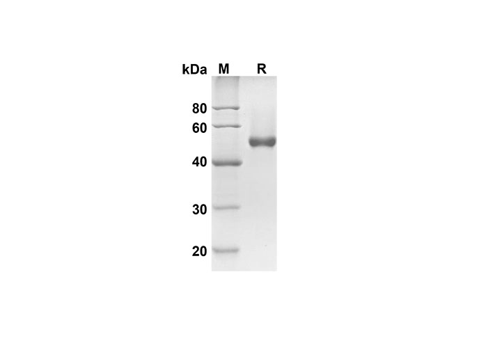 Recombinant Mouse CD30 Protein(His Tag)-产品推荐-1