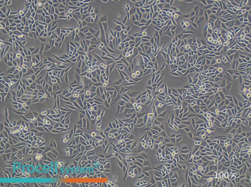 SiHa Cell Complete Medium - 2